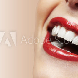 Woman smiling with great teeth on white background