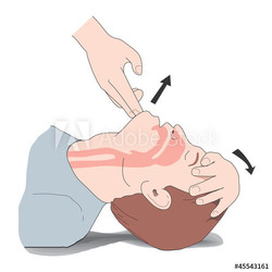 Method of First Aid, Artificial respiration, Reanimation