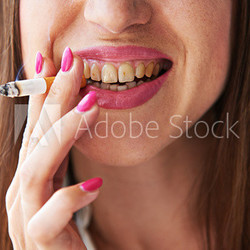 woman with yellow dirty teeth