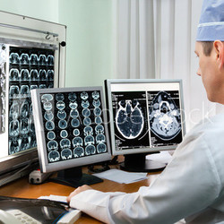 Doctor examining x-ray images